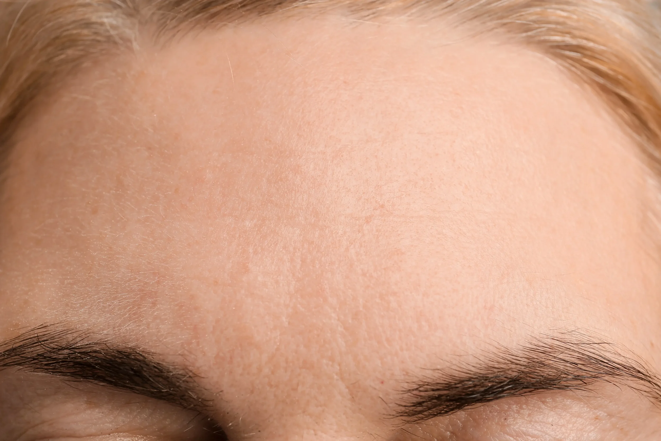 Close-up of a woman's smooth forehead without wrinkles, showing clear and even skin texture above the eyebrows.